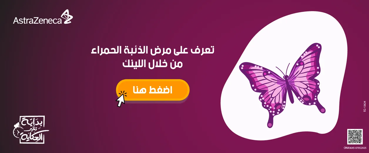 AZ  مرض الذئبة 13-5-2025